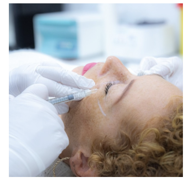 lip filler injections