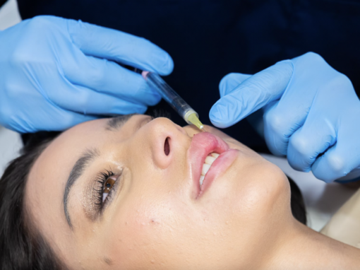 Everything you want to know about Russian Lip fillers!