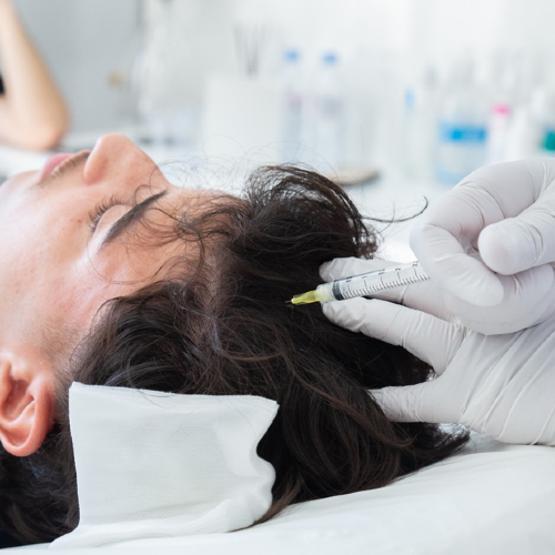PRP HAIR RESTORATION 4 PRP HAIR RESTORATION