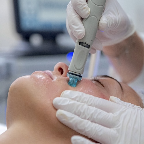 hydrafacial woman