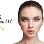 Purity Skin Saver Program