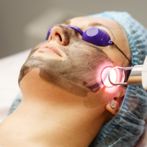 CoolPeel Laser Special
